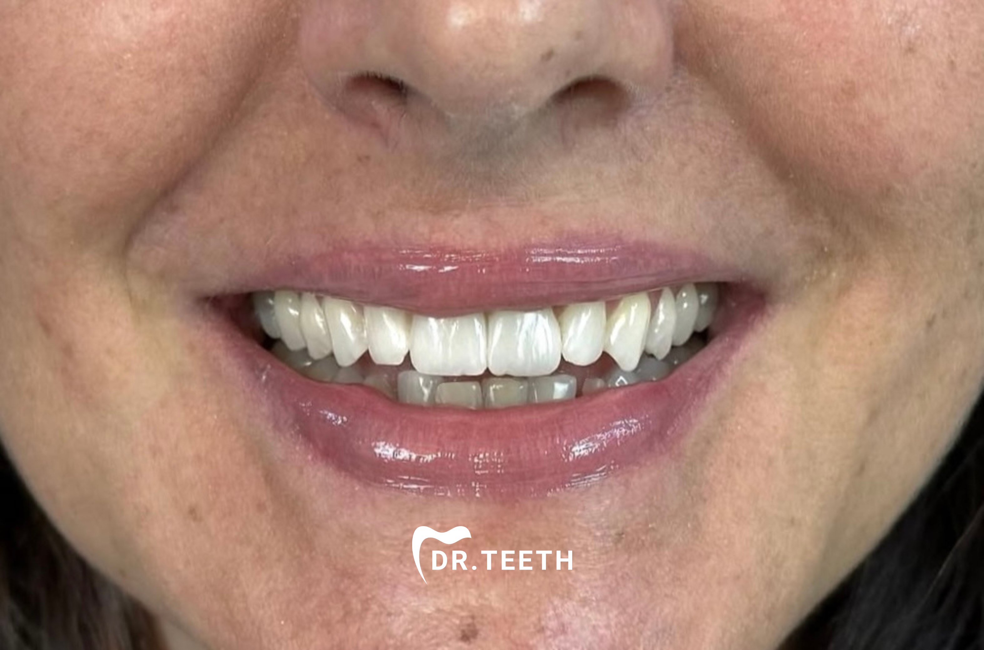 DR. TEETH branded patient result